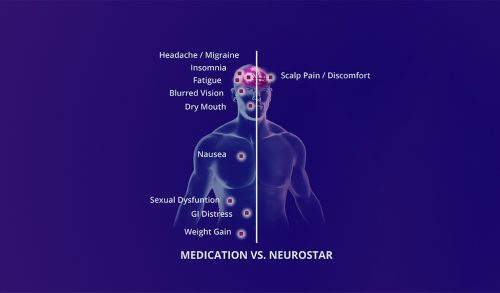NeuroStar Does Not Have the Side Effects of Medication